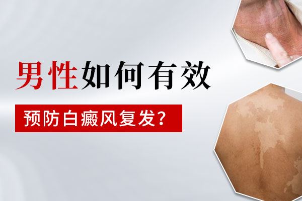 有效治疗腰部白癜风的方法有哪些
